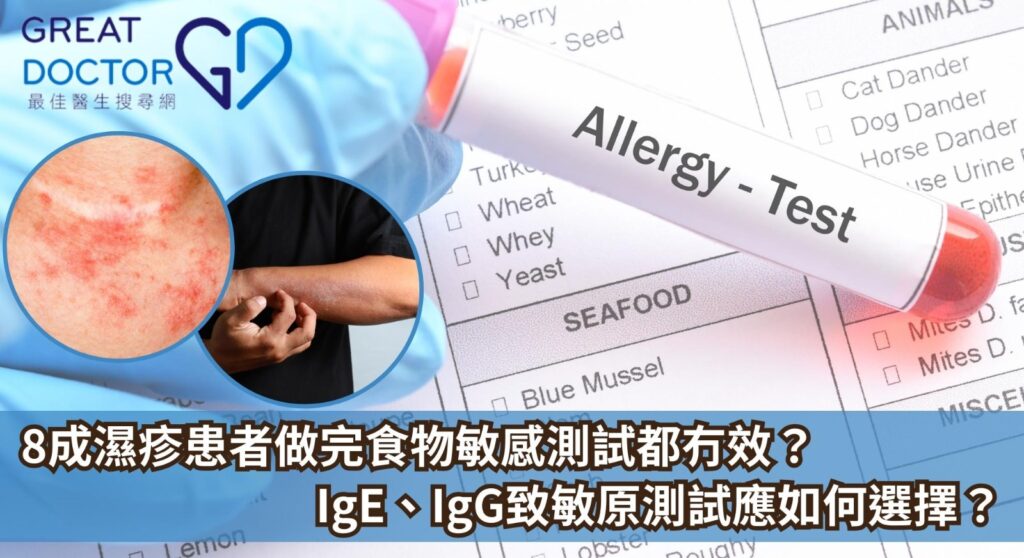8成濕疹患者做完食物敏感測試都冇效? IgE、IgG致敏原測試應該如何選擇?