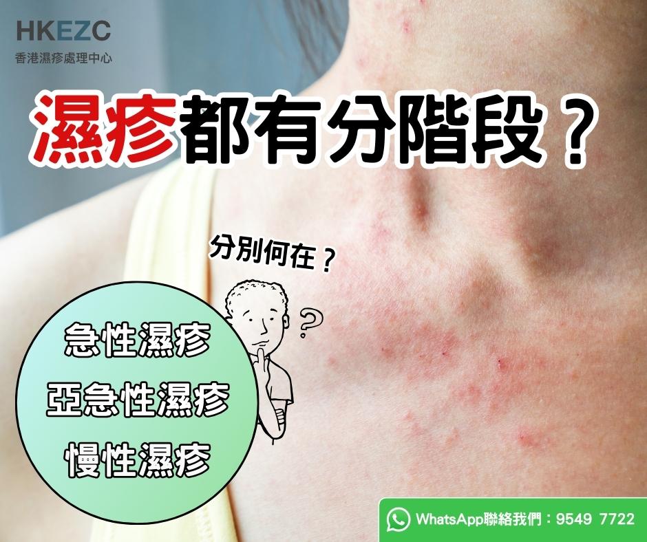 濕疹都有分階段？盡早找出根源處理！