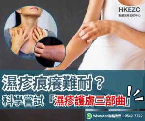 濕疹痕癢難耐?  科學嘗試「濕疹護膚三部曲」