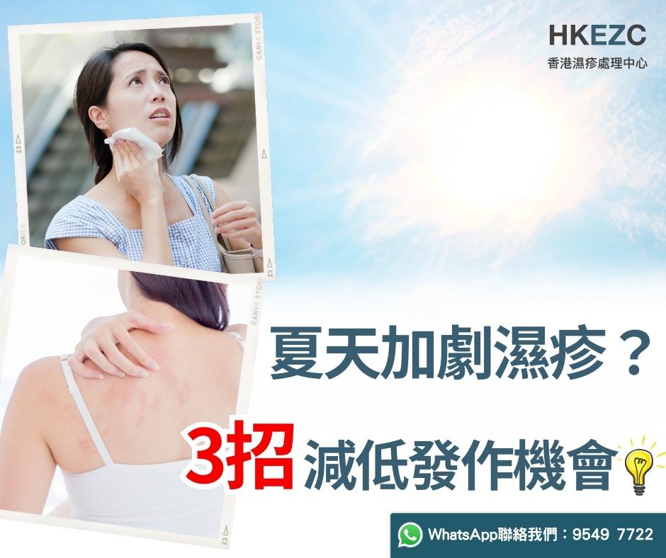 夏天加劇濕疹? 3招助你減低發作機會
