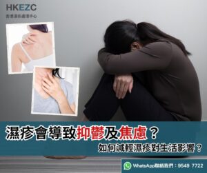 濕疹會導致抑鬱及焦慮？如何減輕濕疹對生活影響？