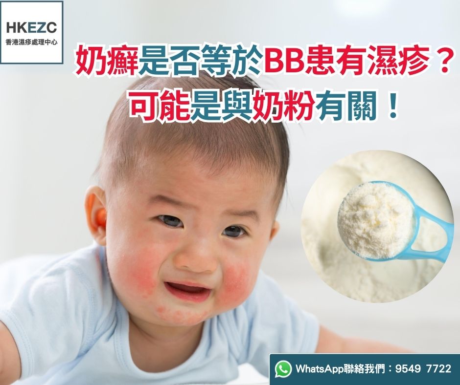 奶癬是否等於BB患有濕疹？可能是與奶粉有關！
