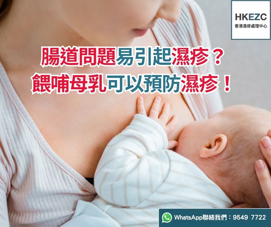 腸道問題易引起濕疹？餵哺母乳可以預防濕疹！